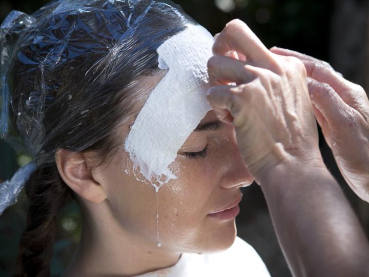 Gipsmaske der er ved at blive lagt 